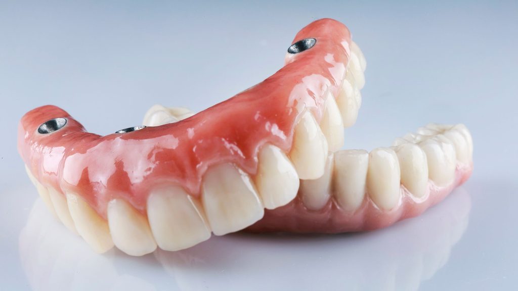 composition+of+dental+prosthese