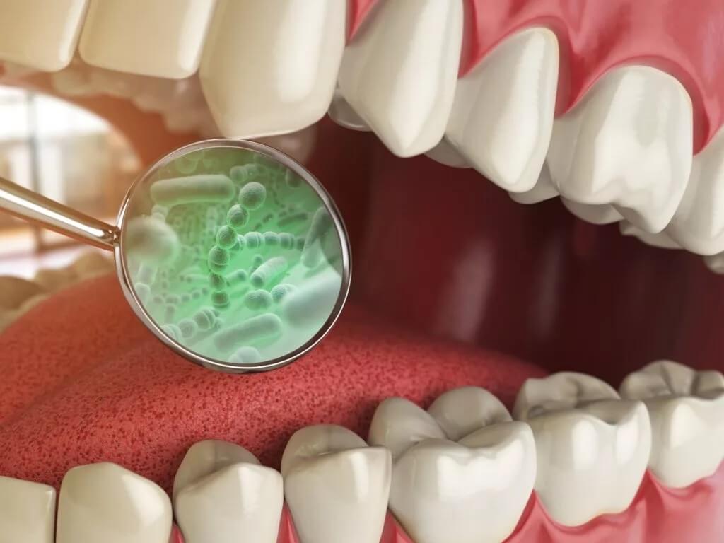 Bad-breath-treatment