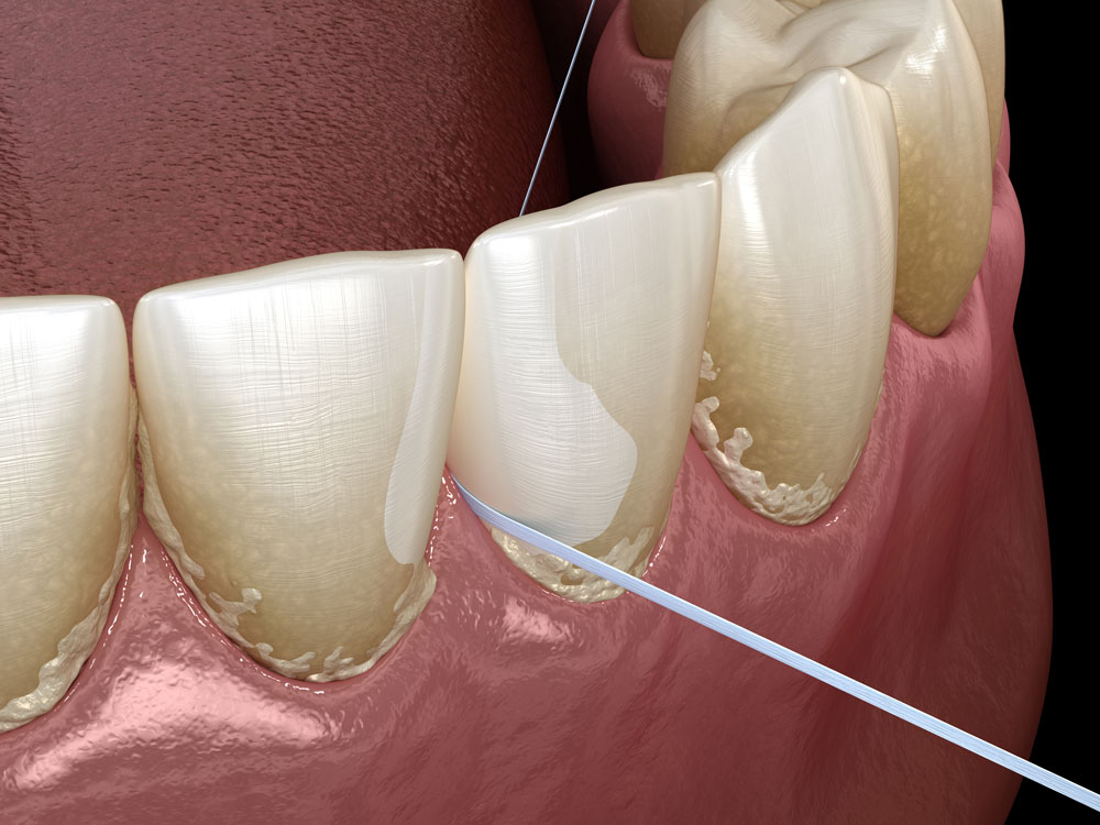 dental-flossing